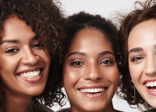 Three smiling women after Diamond Glow treatments