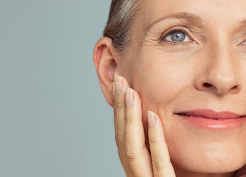 woman with signs of aging skin