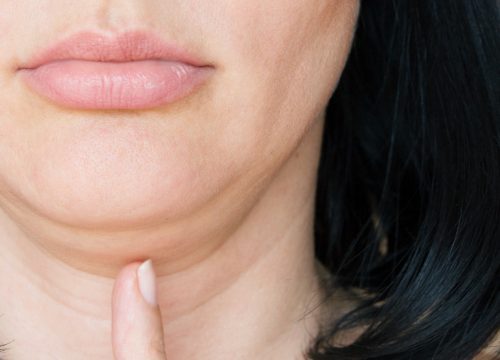 Woman pointing at her double chin