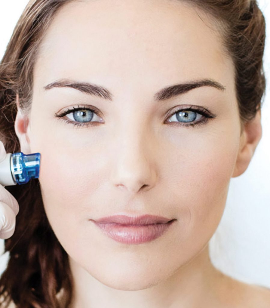 Woman getting a HydraFacial treatment