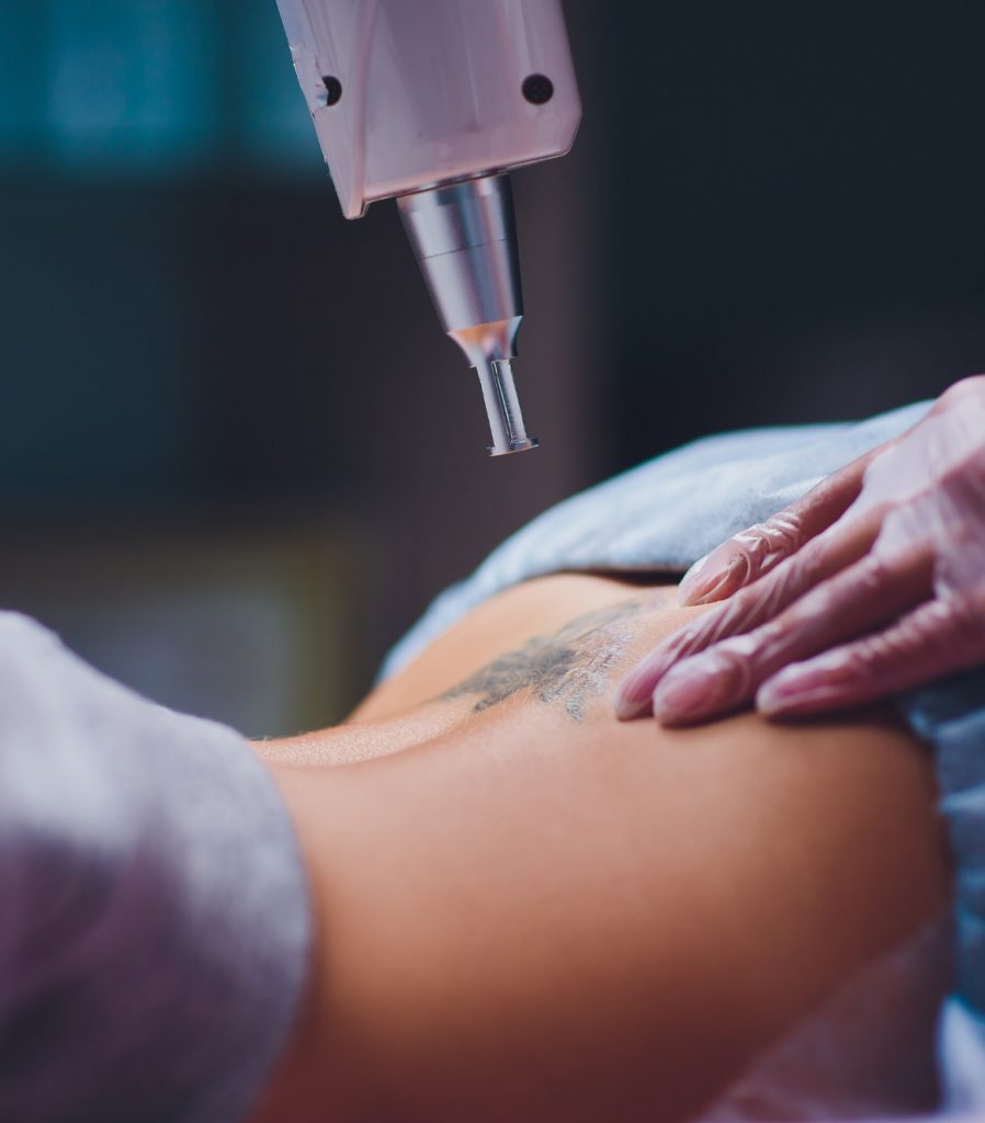 PicoSure® Tattoo Removal | Fresno, CA | Behr Laser & Skin Care Center PicoSure® Tattoo Removal | Fresno, CA | Behr Laser & Skin Care Center