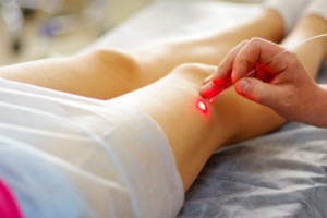 Laser vein therapy