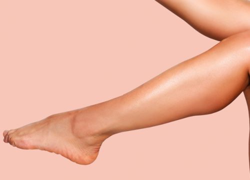 Woman's legs after Vectus Laser Hair Reduction