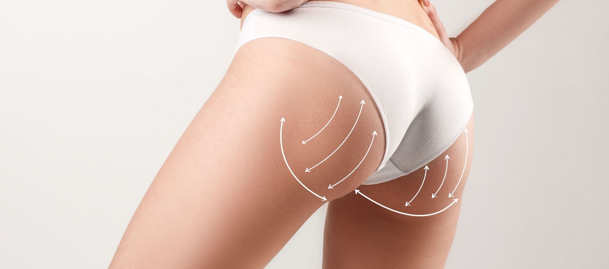 Avéli™ Cellulite Reduction