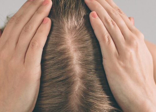 Photo of a woman's head and hair