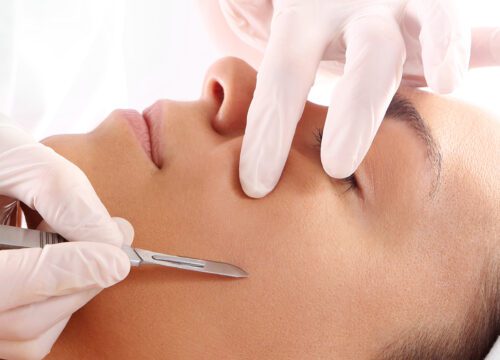 Woman receiving a dermaplane facial