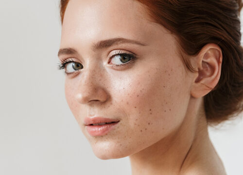 Woman with red hair and freckles