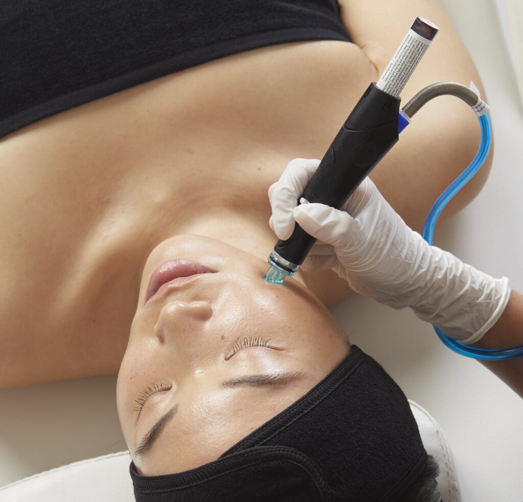 Photo of a woman getting a HydraFacial® Syndeo treatment